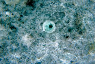Entamoeba histolytica - Photo: CDC/ Dr. George Healy