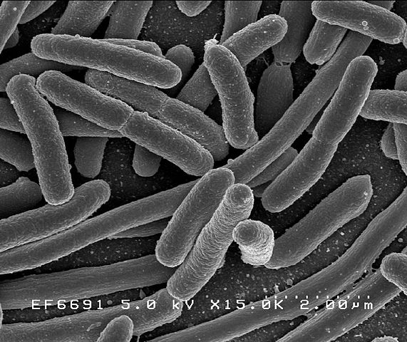 Escherichia coli - Photo: Rocky Mountain Laboratories, NIAID, NIH